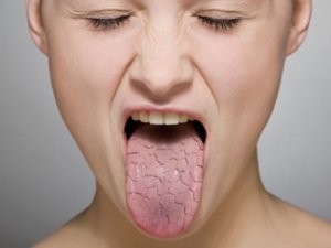 Почему сохнет во рту и как избавиться от неприятного симптома? 