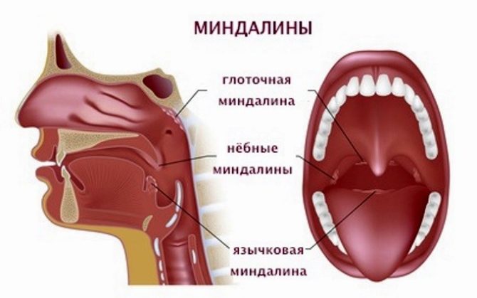 Причины и лечение боли в гландах (миндалинах) 