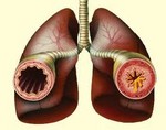Причины и симптомы бронхоспазма у детей и взрослых 