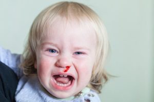 Причины внезапного появления крови из носа у ребёнка 