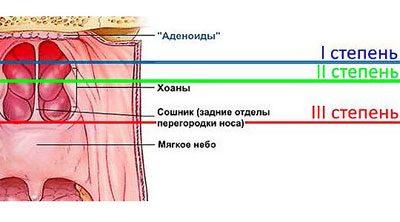 Причины жесткого дыхания у детей 