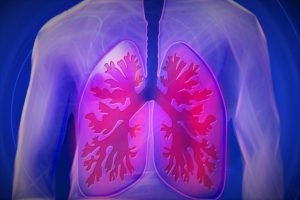 Признаки грибка в лёгких 