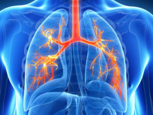 Сколько нужно времени, чтобы полностью вылечить пневмонию? 