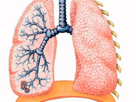 Советы как укрепить легкие и бронхи при бронхите взрослым и детям 