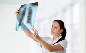 Туберкулёз на рентгене: особенности диагностики 