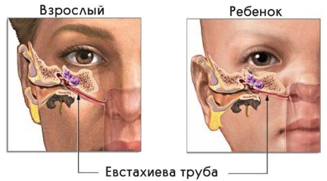 Закладывает ухо при гайморите: что делать 