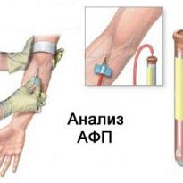 Анализ крови на альфа-фетопротеин и его расшифровка 