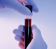 Анализы крови – сроки годности и сроки готовности 