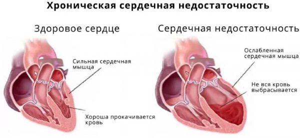 Аспаркам – инструкция по применению 