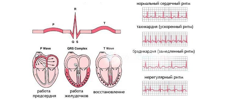 Синусовая аритмия у ребенка 7 лет 