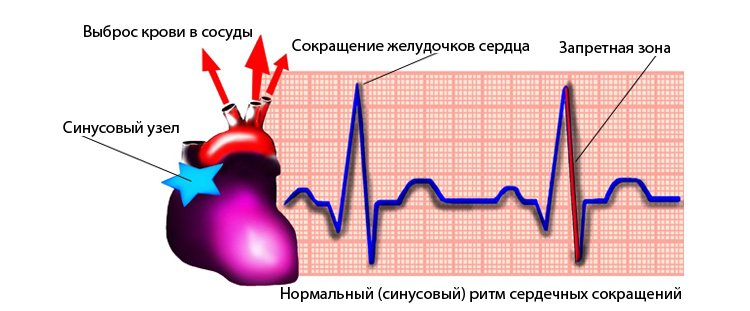 Синусовый ритм: суть, отражение на ЭКГ, норма и отклонения, особенности 