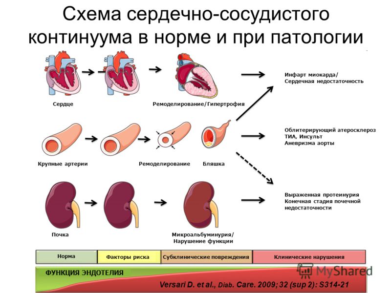 Вопросы диагноза: концентрическое ремоделирование левого желудочка 