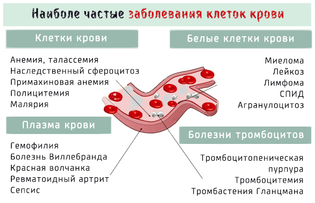 Заболевания крови: симптомы, лечение, причины, анализы 