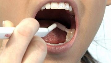 Для чего нужны монопучковые зубные щетки (монощетки), и как ими правильно пользоваться? 