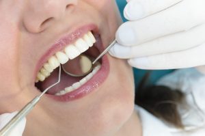 Электрофорез, УВЧ-терапия и другие виды физиолечения в стоматологии: особенности проведения процедур, польза для зубов 