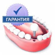 Гарантийные обязательства на имплантацию зубов в стоматологии 
