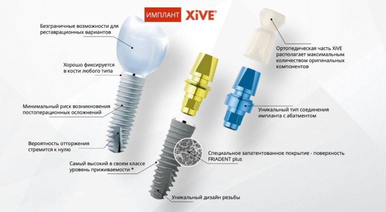 Импланты XIVE Friadent – немецкое качество, обзор цен 