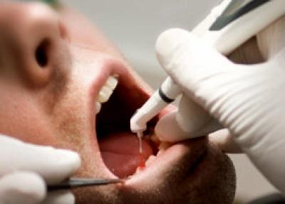 Как долго болит зуб после пломбирования 