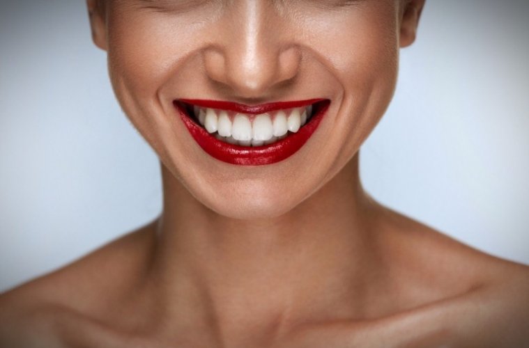 Какие импланты зубов лучше? 