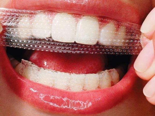 Какие полоски для отбеливания зубов лучше купить в аптеке, обзор 2017 
