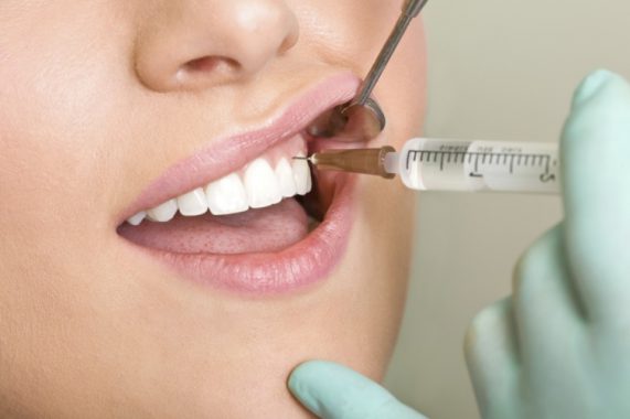 Как и в каких случаях удаляют нерв зуба, больно ли? Фото и видео 