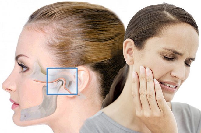 Как лечить артрит челюстно-лицевого сустава? 