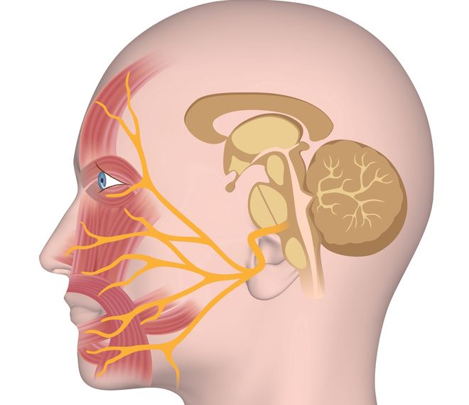 Как лечить защемление лицевого нерва 