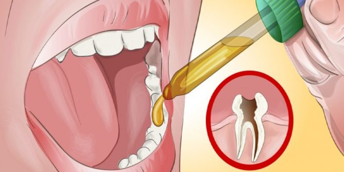 Как лечить зубную боль в домашних условиях 