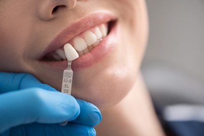 Какова альтернатива имплантации зубов? 