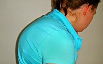 Горб на спине: причины и лечение патологии 