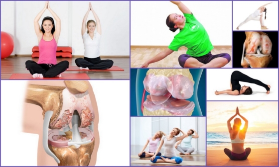 Йога: эффективность при артрозе коленного сустава 