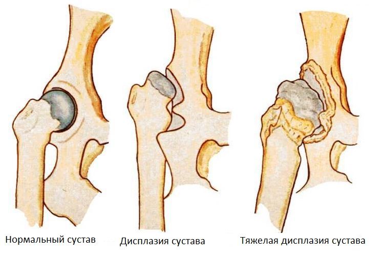 Как лечить дисплазию тазобедренного сустава у собак 