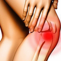 Как лечить гонартроз коленного сустава 2 степени: 6 методик 
