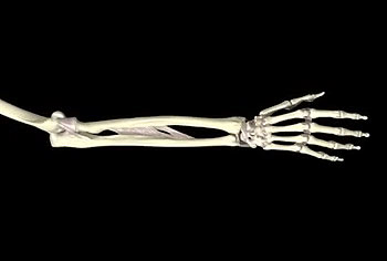 Каковы причины болей в костях рук и что с этим делать 