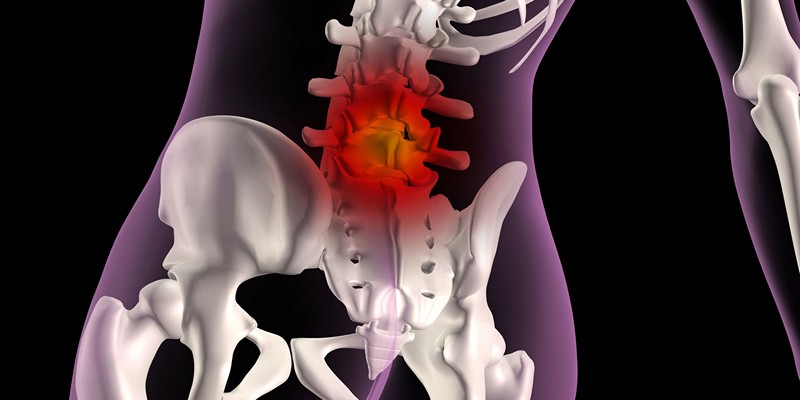 Как распознать грыжу позвоночника? 