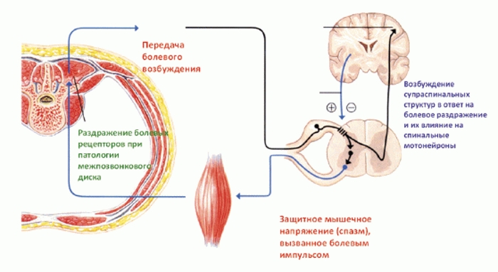 Как снять спазм мышц 