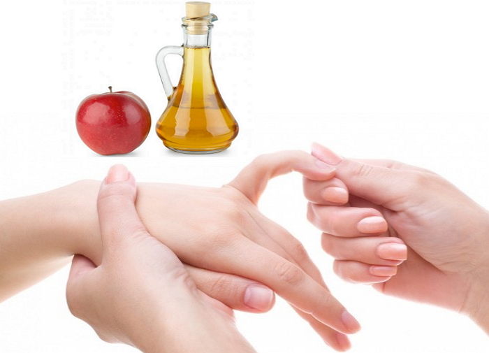 Как вылечить артрит яблочным уксусом? 