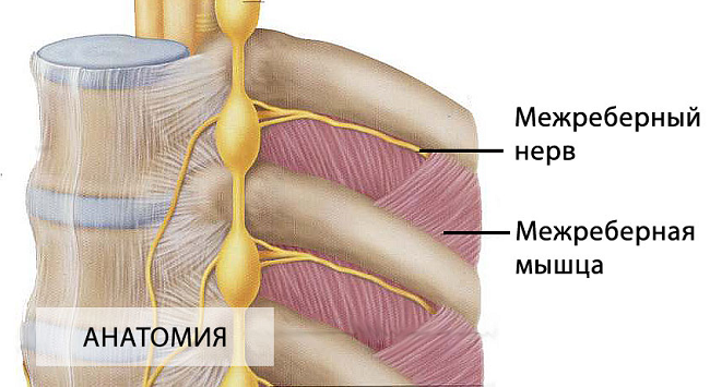 Как вылечить межреберную невралгию медикаментозно 