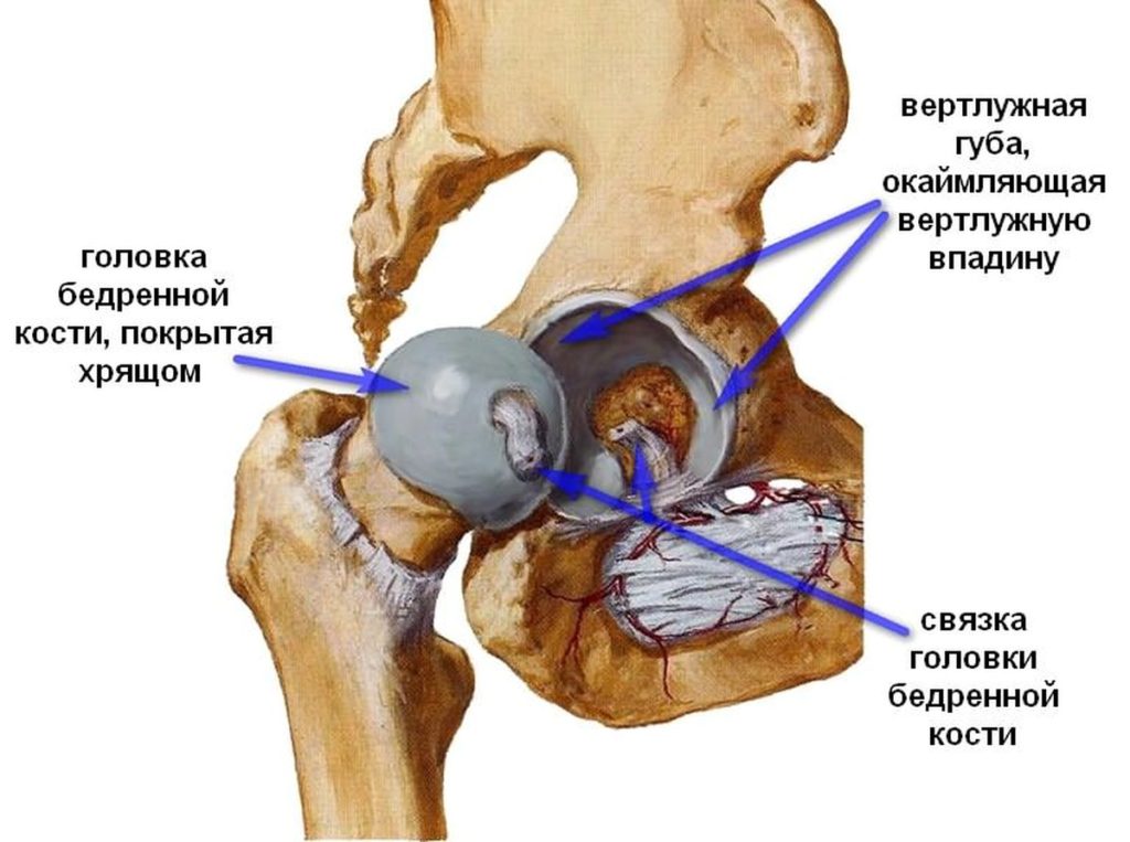 Коксартроз тазобедренного сустава 2 степени что это такое, симптомы, как лечить? 