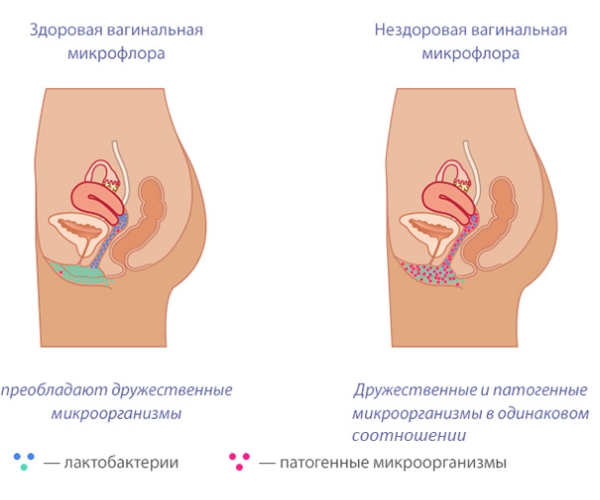 Когда и почему перед мecячными пропадают влагалищные выделения 