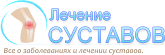 Лечение артроза народными средствами в домашних условиях 