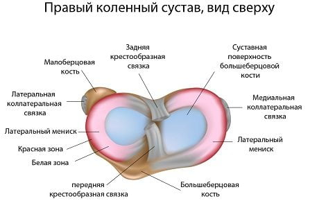 Лечение мениска коленной чашечки 