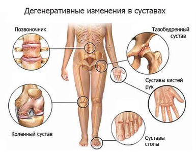 Лечение позвоночника и суставов 