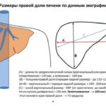 Норма размеров печени по УЗИ 