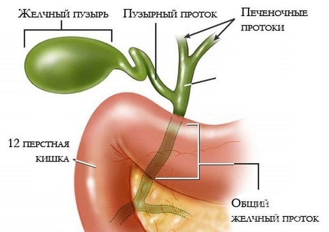 Острый холецистит 