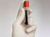 Почему забор крови на анализ делают из вены 