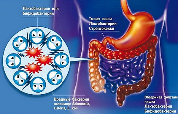 Диета при дисбактериозе кишечника 