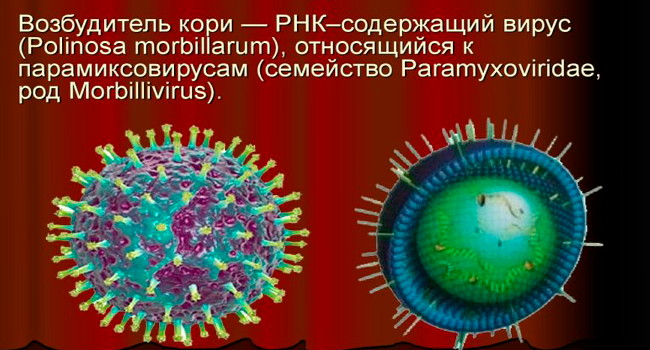 Корь при беременности 