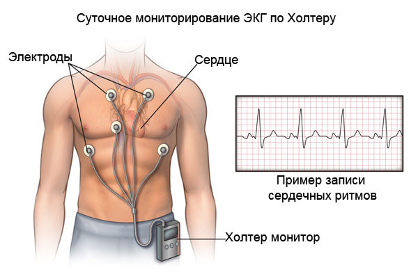 Лечение боли в гpyди и головокружений: как они связаны и причины их появлений 