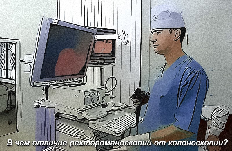 Ректороманоскопия кишечника, что это такое, отличия от колоноскопии, видео 